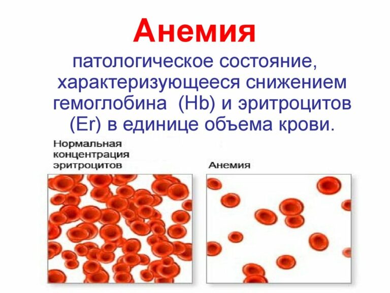 Дефицит железа картинки